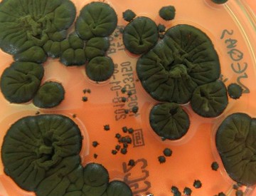 C. sphaerospermum yang mengalami melanisasi (Foto: Rui Tomé/Atlas of Mycology)